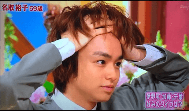 伊野尾慧はハゲているのか